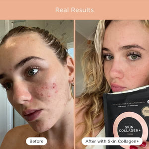 Tropeaka - Skin Collagen+